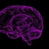 Beyne müdahalede edebilen sistem, Gamma Knife nedir?