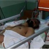 Hastaneye getirilen Suriyeli'den el bombası çıktı! Hastaneye getirilen Suriyeli'den el bombası çıktı!
