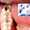 Aspirinin diş çürüklerine iyi geldiği ortaya çıktı