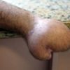 Çığır açan yöntem! Eli midesine dikildi Çığır açan yöntem! Eli midesine dikildi