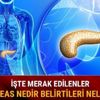 Pankreas nedir Pankreas kanseri belirtileri evreleri nelerdir tedavisi mi mümkün mü
