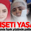 Dehşeti yaşadı! Havai fişek yüzünde patladı