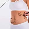 Liposuction nedir Liposuction nedir