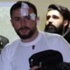 Patlamada Yaralanan Şahıs Taburcu Edildi Patlamada Yaralanan Şahıs Taburcu Edildi