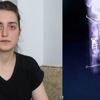 Yanlış parmağın ameliyat edildiği iddiası Yanlış parmağın ameliyat edildiği iddiası