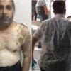 Hortum, kırbaç ve elektrikle işkence edilen adamı polis kurtardı
