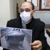 Flaş gelişme! Dalağı kaybolmuştu!