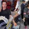 Kızların Facebook kavgası kanlı bitti Kızların Facebook kavgası kanlı bitti