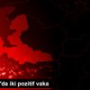 Altınordu da iki pozitif vaka Altınordu da iki pozitif vaka