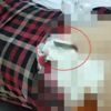 Sırtına saplanan bıçakla hastaneye kaldırıldı Sırtına saplanan bıçakla hastaneye kaldırıldı