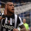 Arturo Vidal resmen Bayern'de