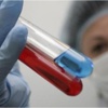 AIDS ile mücadelede dev adım AIDS ile mücadelede dev adım