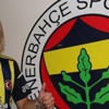 Krasic'in Fibula kemiği kırıldı Krasic'in Fibula kemiği kırıldı