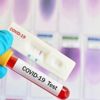 PCR testi nedir? PCR testi nasıl, nerede yapılır?