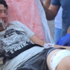 Gitar Kavgası Kanlı Bitti: 1 Yaralı