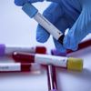 New York'ta test edilmeyen 3 bin 700 kişinin daha Kovid-19'dan öldüğü ortaya çıktı