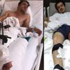 Devrilen çınarın altında kaldı, ailesi ilgisizliğe isyan etti