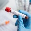 HIV artık ölümcül değil kronik bir hastalık!