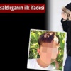Kıskandığı için yüzüne asit atmış
