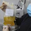 Bir asırlık tedavi yöntemi umut oldu