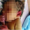 Karıncaların yediği bebek ölümden döndü (+18)