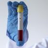 KKTC'de endişelendiren gelişme: 75 gün sonra 4 yeni koronavirüs vakası görüldü