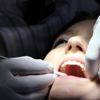 Diş eksikliğine implantla çözüm Diş eksikliğine implantla çözüm