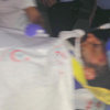 Husumetlisiyle randevulaştı, av tüfeğiyle vuruldu Husumetlisiyle randevulaştı, av tüfeğiyle vuruldu
