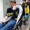 Elinde havai fişek patladı Elinde havai fişek patladı
