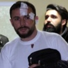 Patlamada yaralanan şahıs taburcu edildi