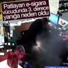E-sigara patladı