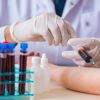 Hematoloji nedir? Hangi hastalıklara bakar? Hematoloji nedir? Hangi hastalıklara bakar?