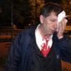 Yeniçağ Gazetesi Yazarı Demirağ'ın saldırıya uğramasıyla ilgili 2 gözaltı