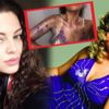 Sinem Umaş'ın kolları yandı Sinem Umaş'ın kolları yandı