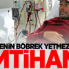Bir ailenin böbrek yetmezliği ile imtihanı Bir ailenin böbrek yetmezliği ile imtihanı