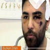 Kahraman Türk Alman kanalına konuştu Kahraman Türk Alman kanalına konuştu
