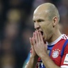 Robben'i timsah ısırdı Robben'i timsah ısırdı