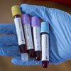 Japonya'da koronavirüsten hayatını kaybedenlerin sayısı 104 oldu