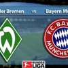 CANLI Werder Bremen Bayern Münih CANLI Werder Bremen Bayern Münih