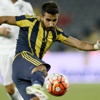 Alper Potuk'un eline alçı Alper Potuk'un eline alçı