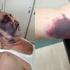 Darbedilen yüzde 90 engelli Mümin Kara entübe edildi Darbedilen yüzde 90 engelli Mümin Kara entübe edildi