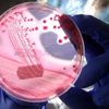 DNA'daki genomlarda değişiklik yapmayı kolaylaştıran enzim keşfedildi
