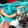 5 yaşındaki çocuğun eli, kıyma makinesine sıkıştı