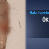 Öksürünce içinden öyle birşey çıktı ki