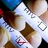 Sosyal medyada HIV Pozitiflere özel site Sosyal medyada HIV Pozitiflere özel site