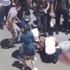 Kazada ağır yaralanan motosiklet sürücüsü hayatını kaybetti Kazada ağır yaralanan motosiklet sürücüsü hayatını kaybetti