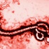 Ebola virüsü hakkında öğrenmeniz gerekenler
