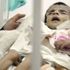Yemen'de yarım milyon çocuk ölüm tehlikesiyle karşı karşıya