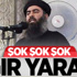 Bağdadi Ağır Yaralı