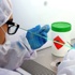 Ebola dakikalar içerisinde test edilebilecek